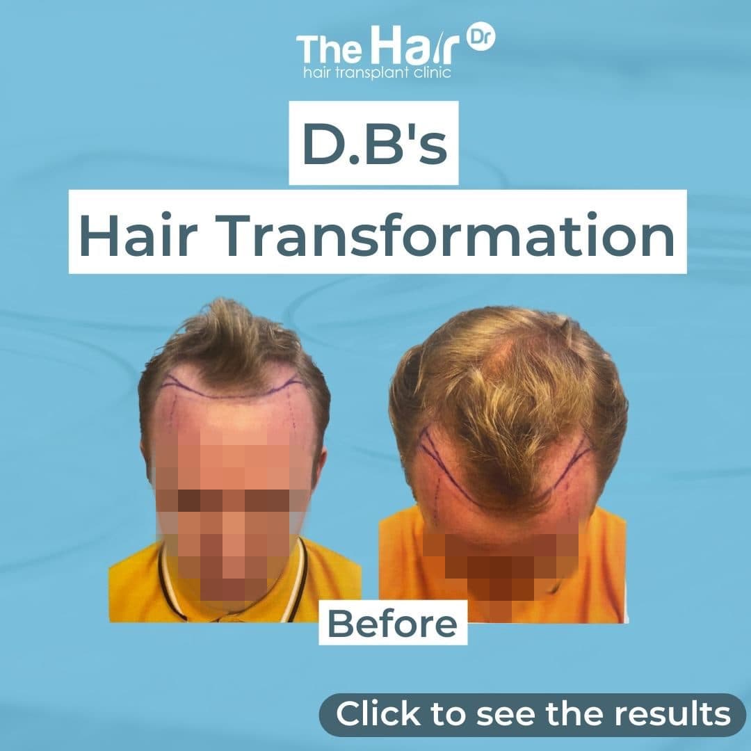 Patient transformation slide 1