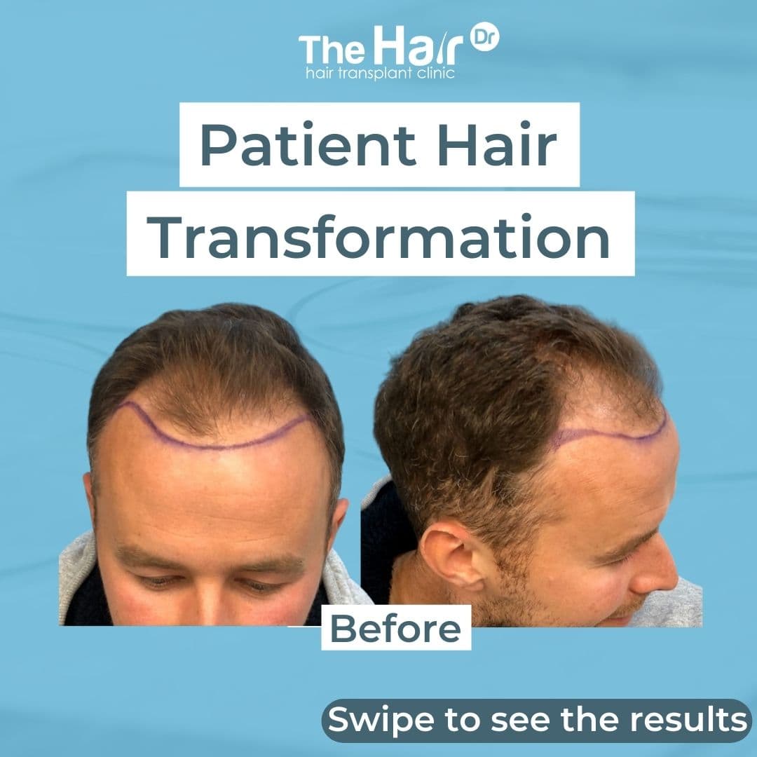 Patient transformation slide 1