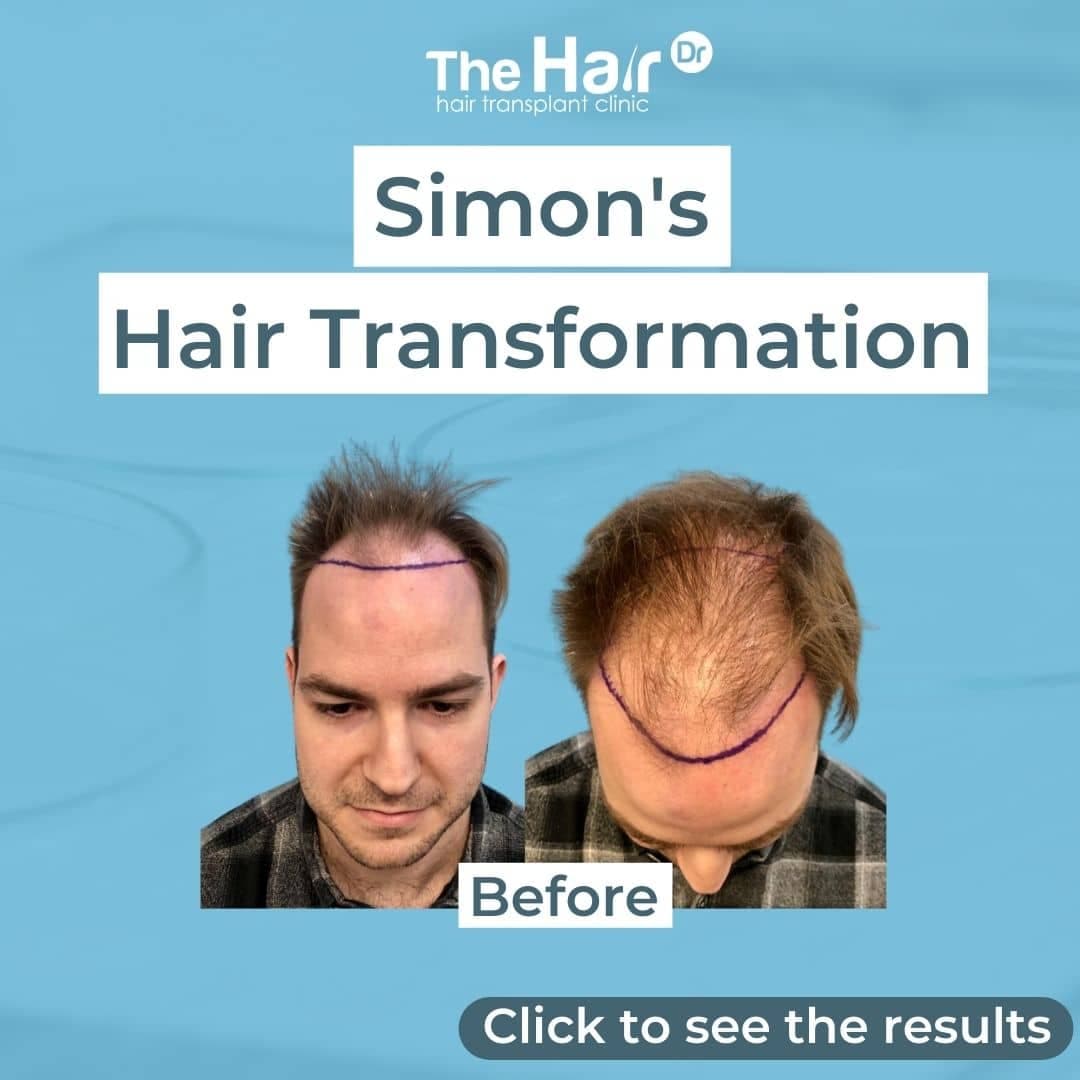 Patient transformation slide 1