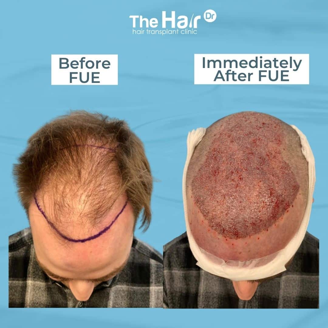 Patient transformation slide 3