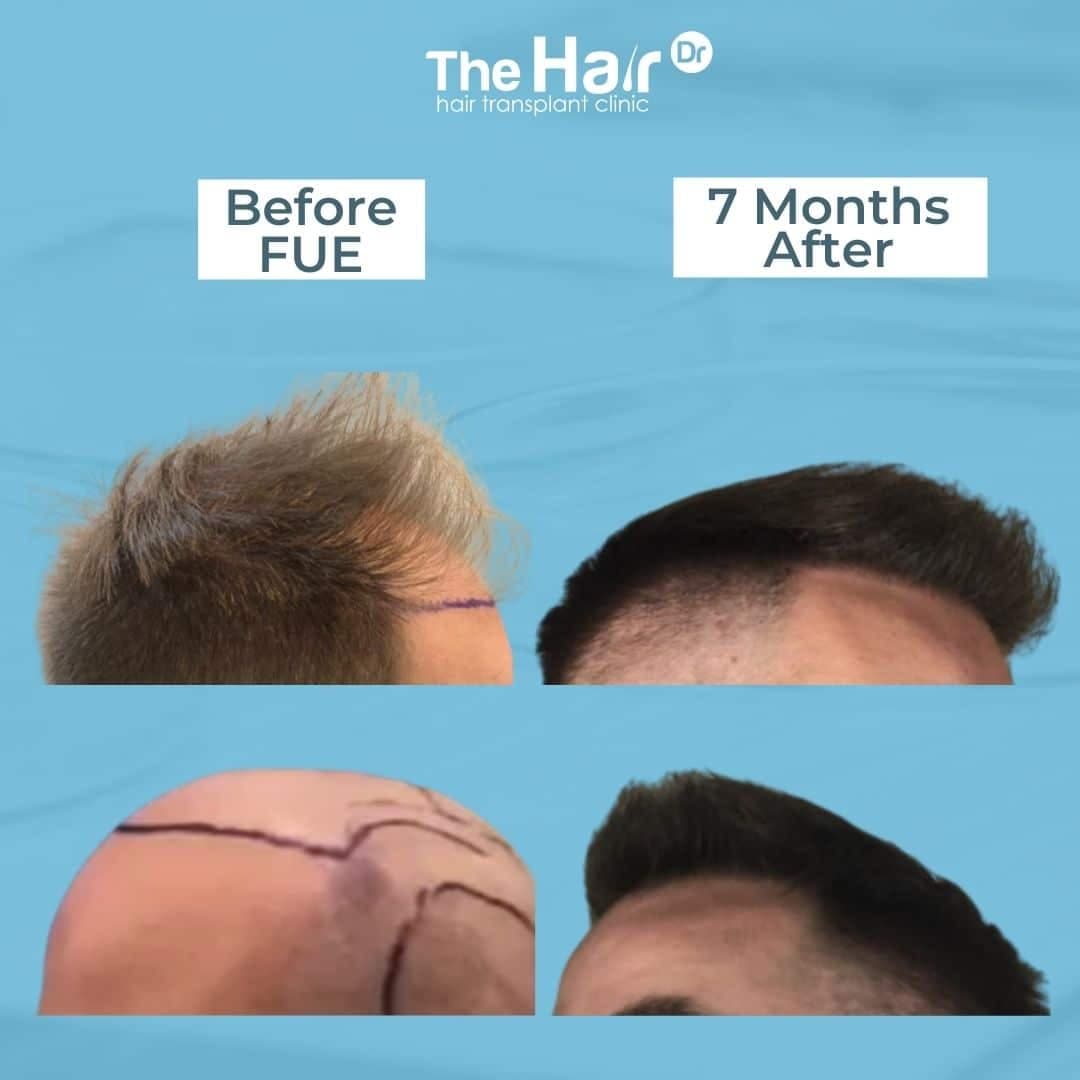 Patient transformation slide 9