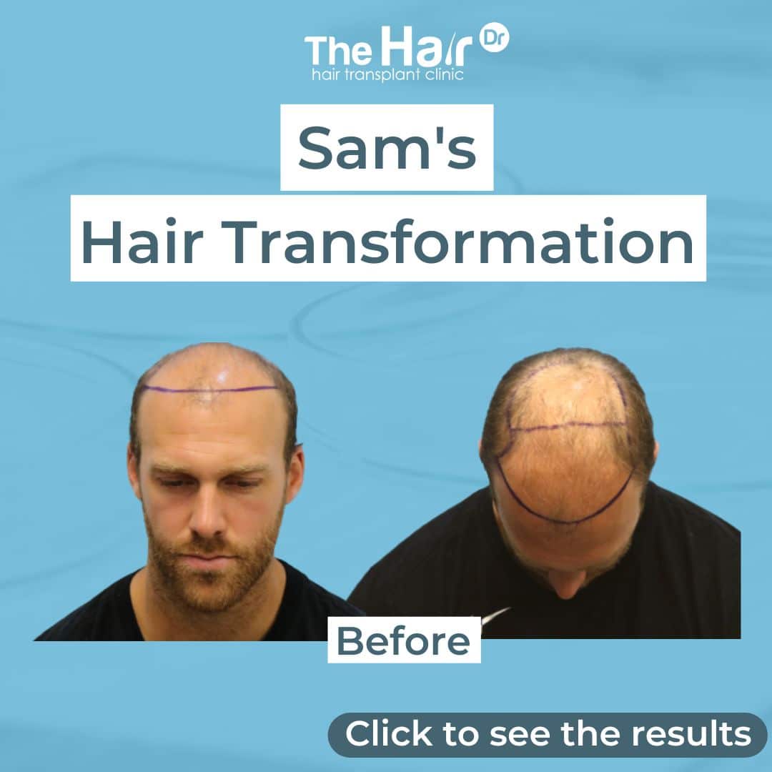 Patient transformation slide 1