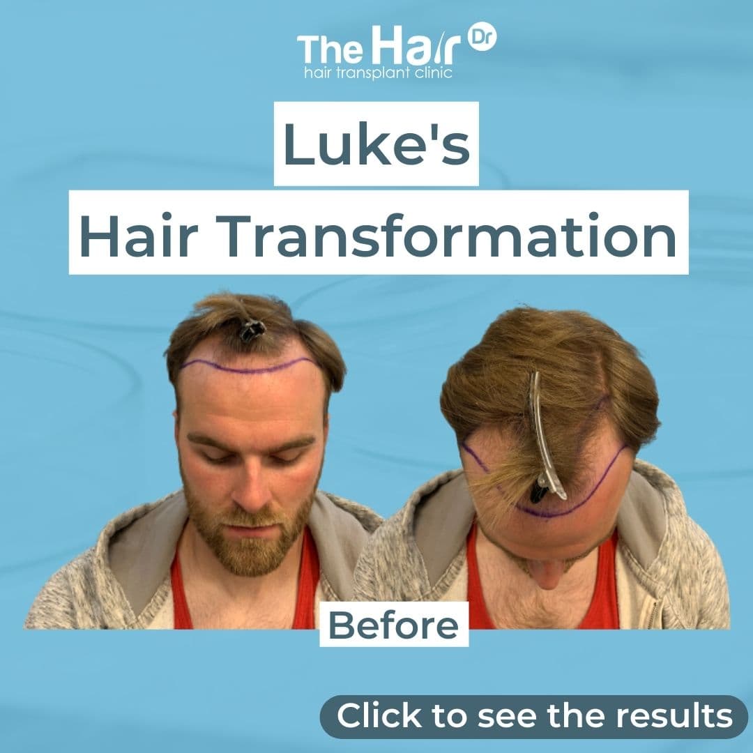Patient transformation slide 1