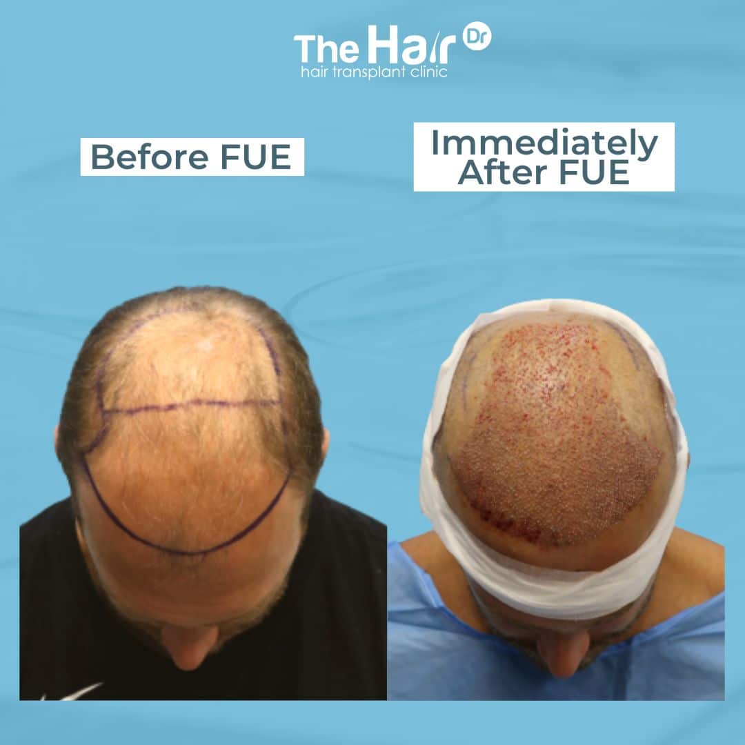 Patient transformation slide 3