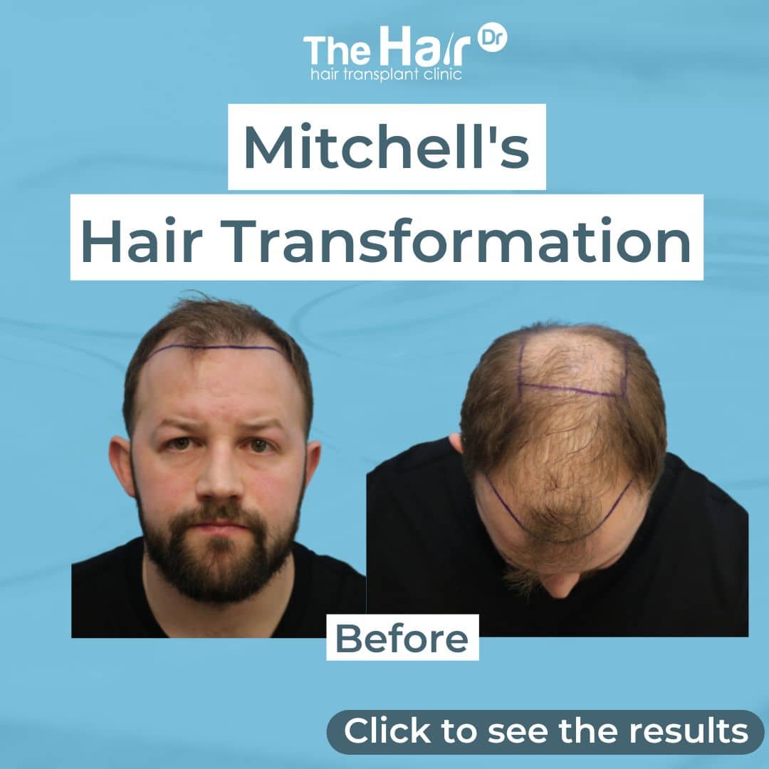 Patient transformation slide 1