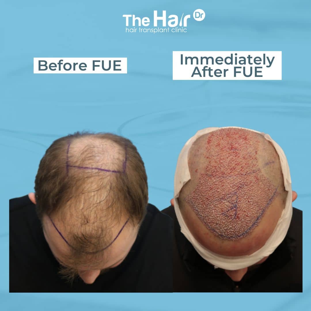 Patient transformation slide 3