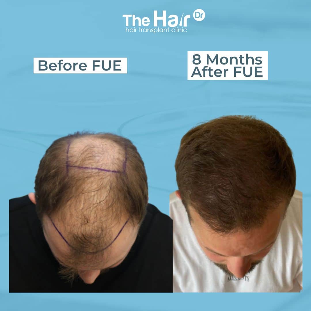 Patient transformation slide 4
