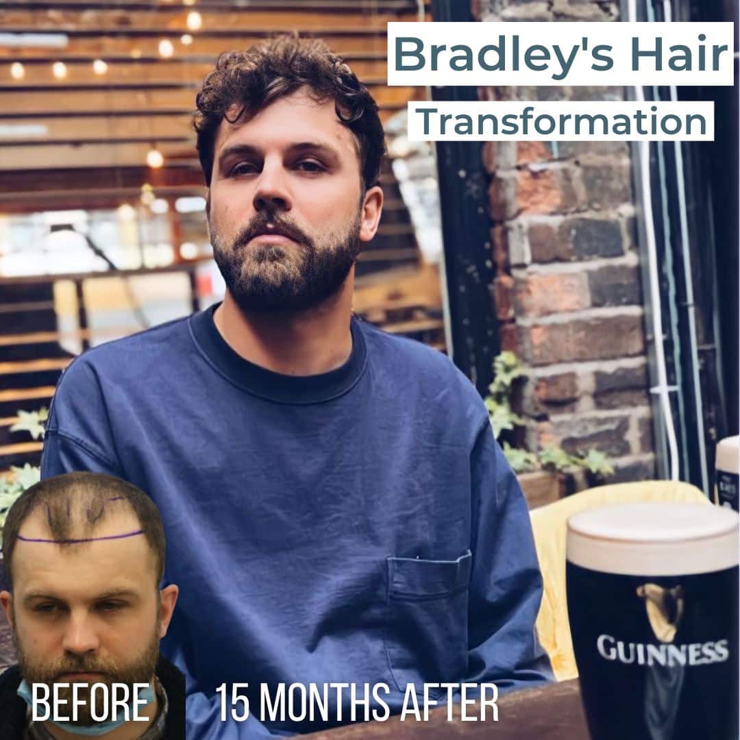 Patient transformation slide 7