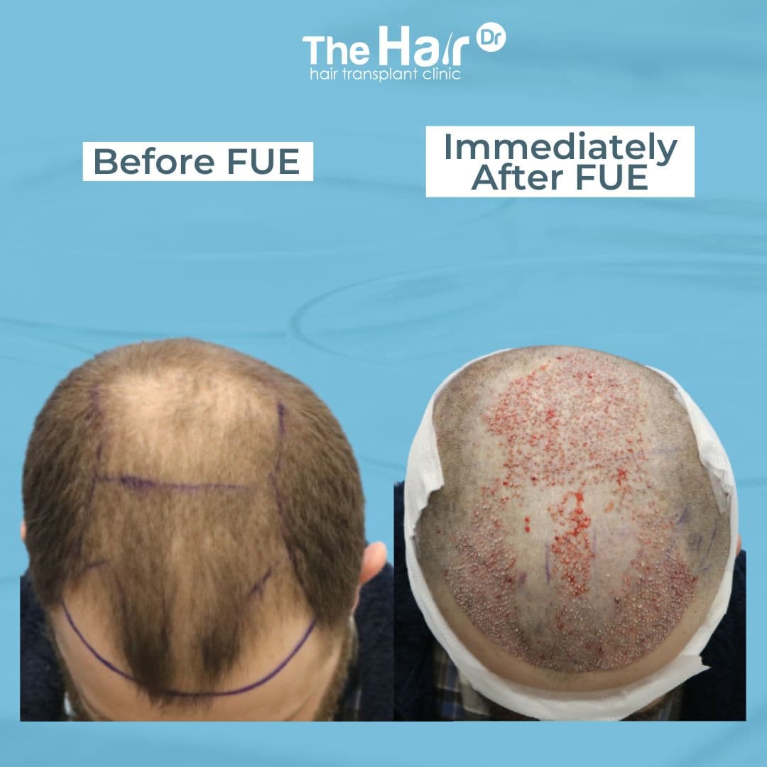 Patient transformation slide 2