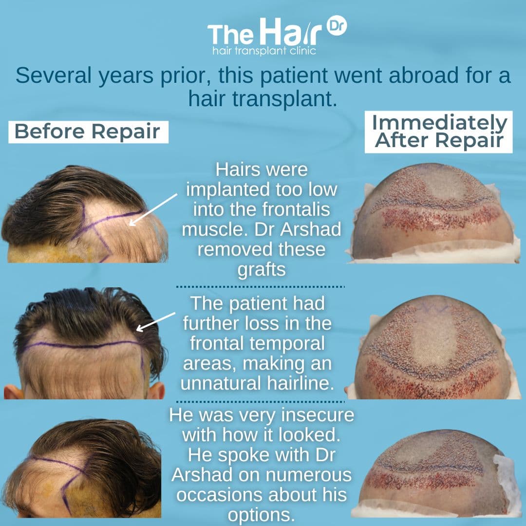Patient transformation slide 3