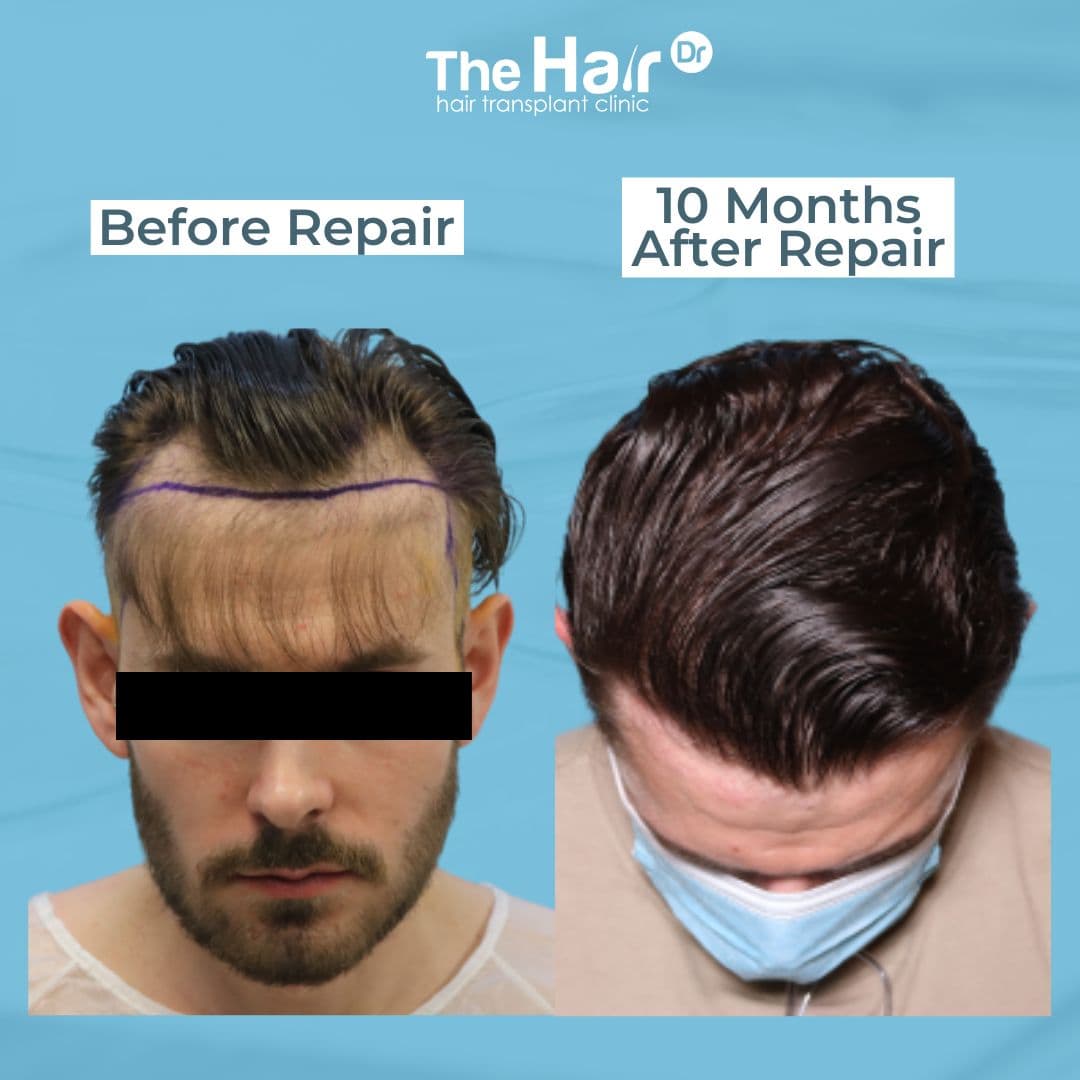 Patient transformation slide 4