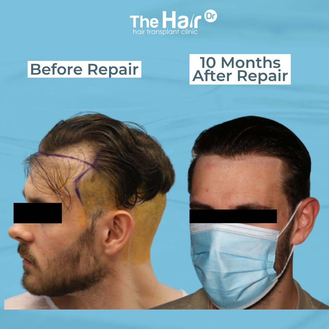 Patient transformation slide 6