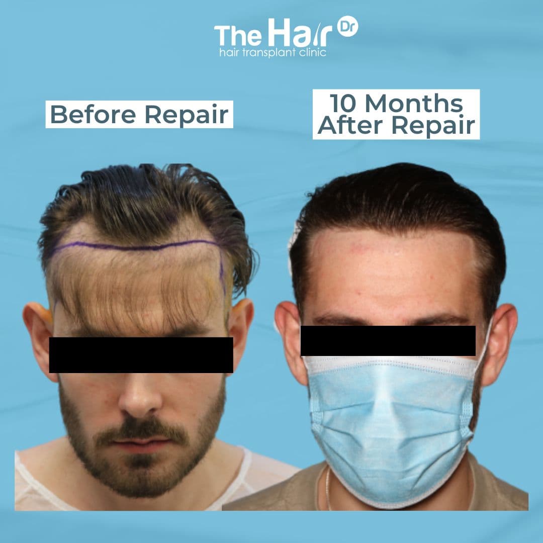Patient transformation slide 7