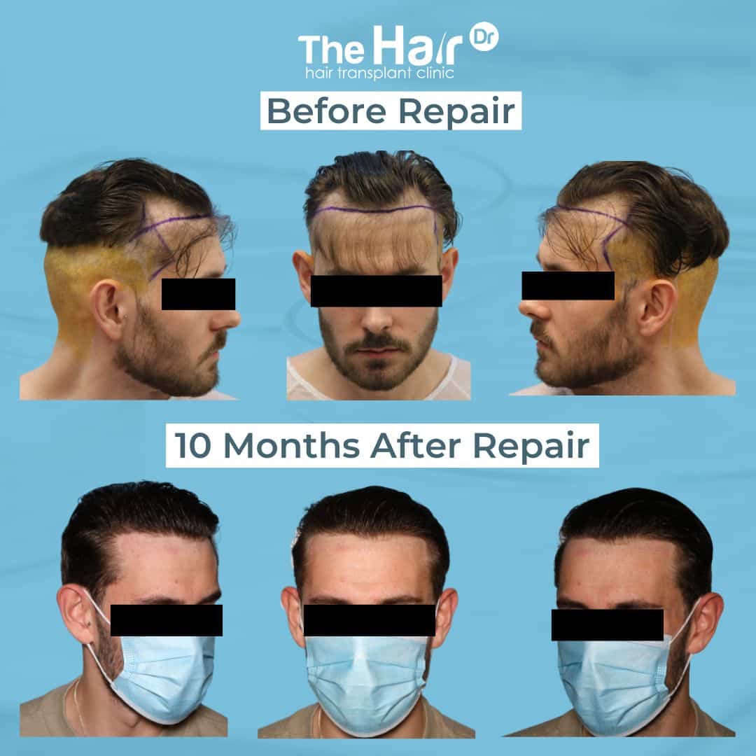 Patient transformation slide 8