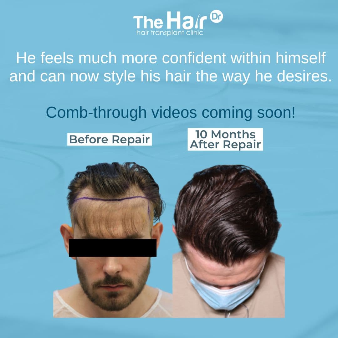 Patient transformation slide 1