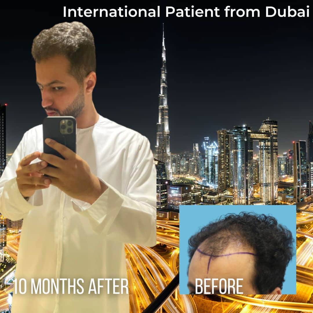 Patient transformation slide 4