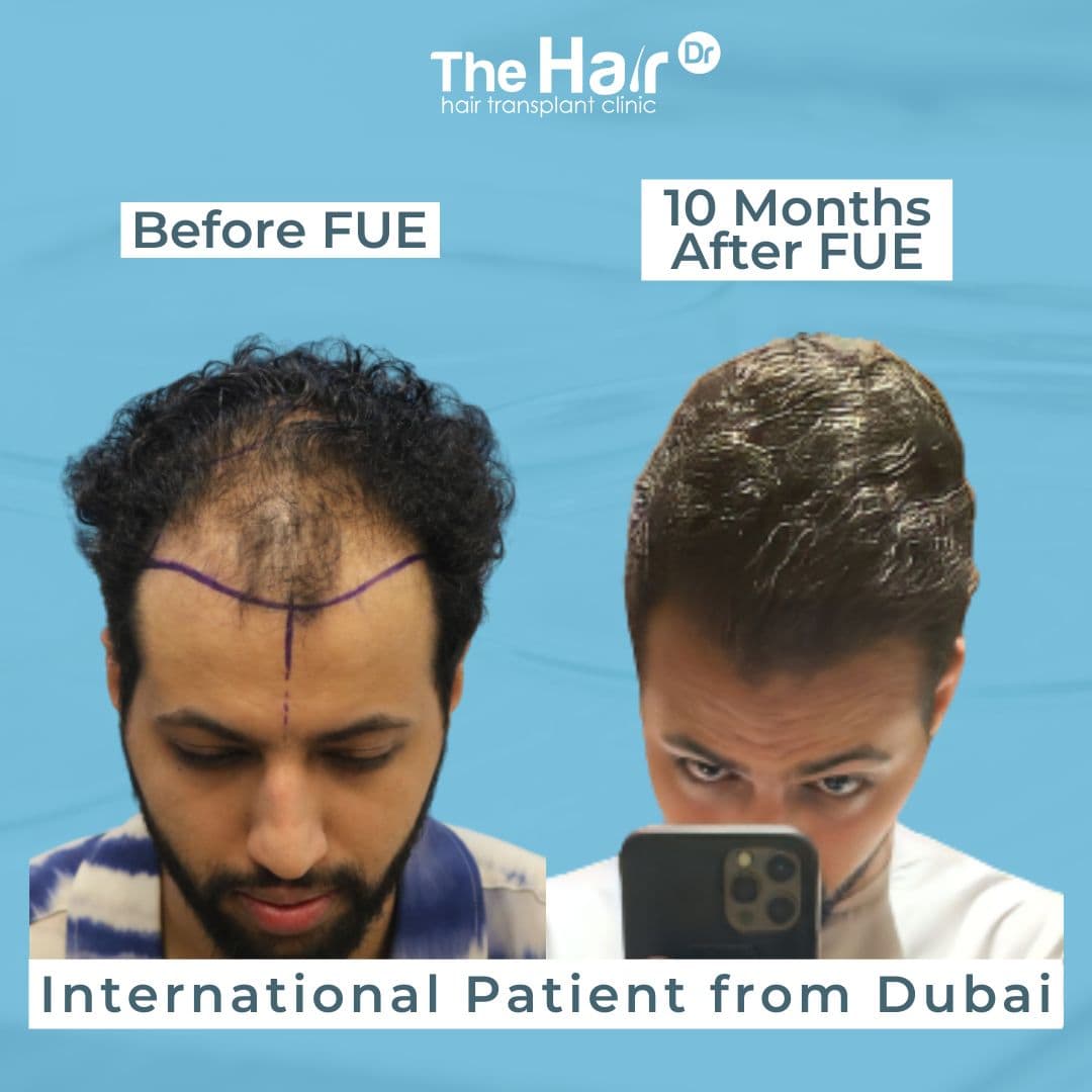Patient transformation slide 1