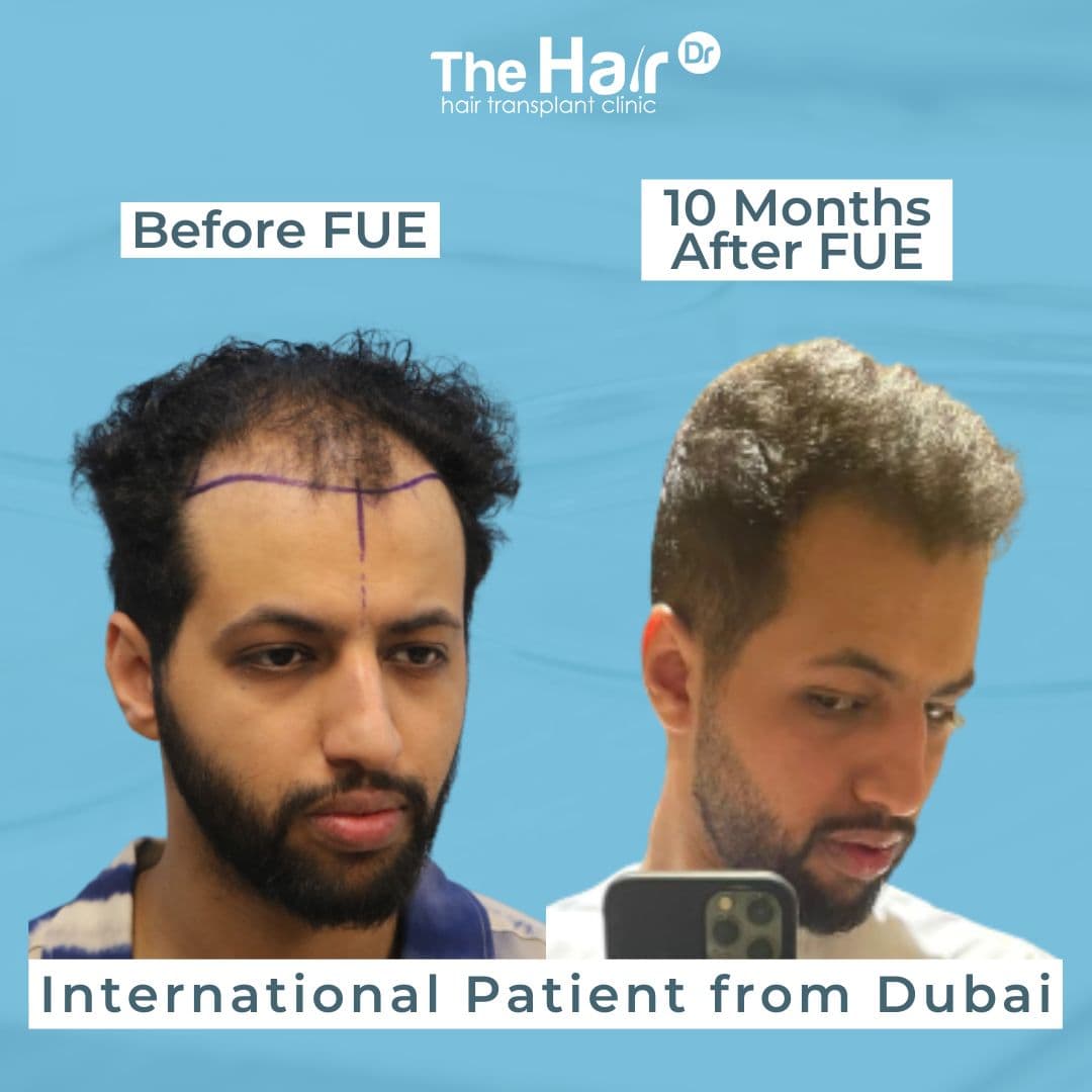 Patient transformation slide 3