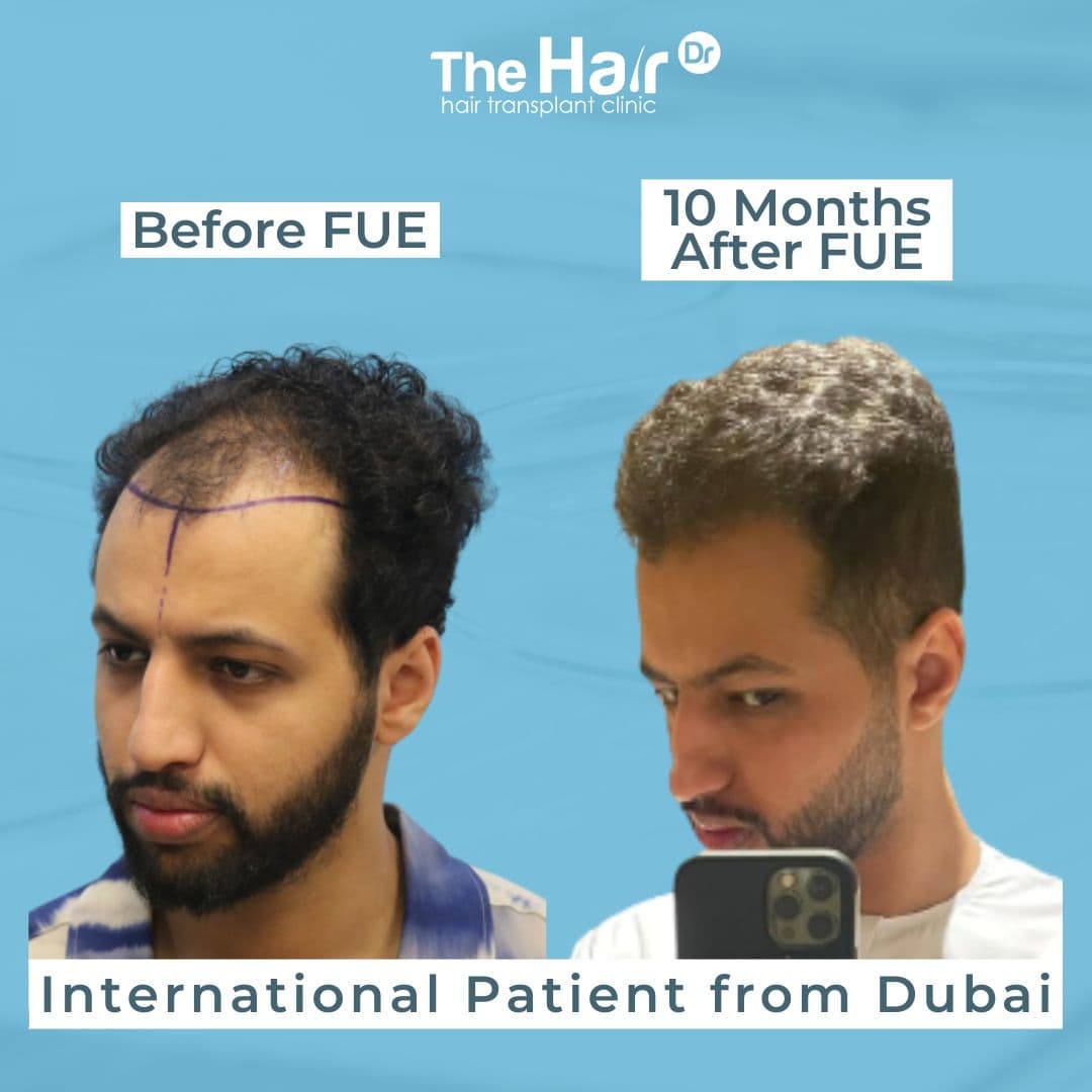 Patient transformation slide 2