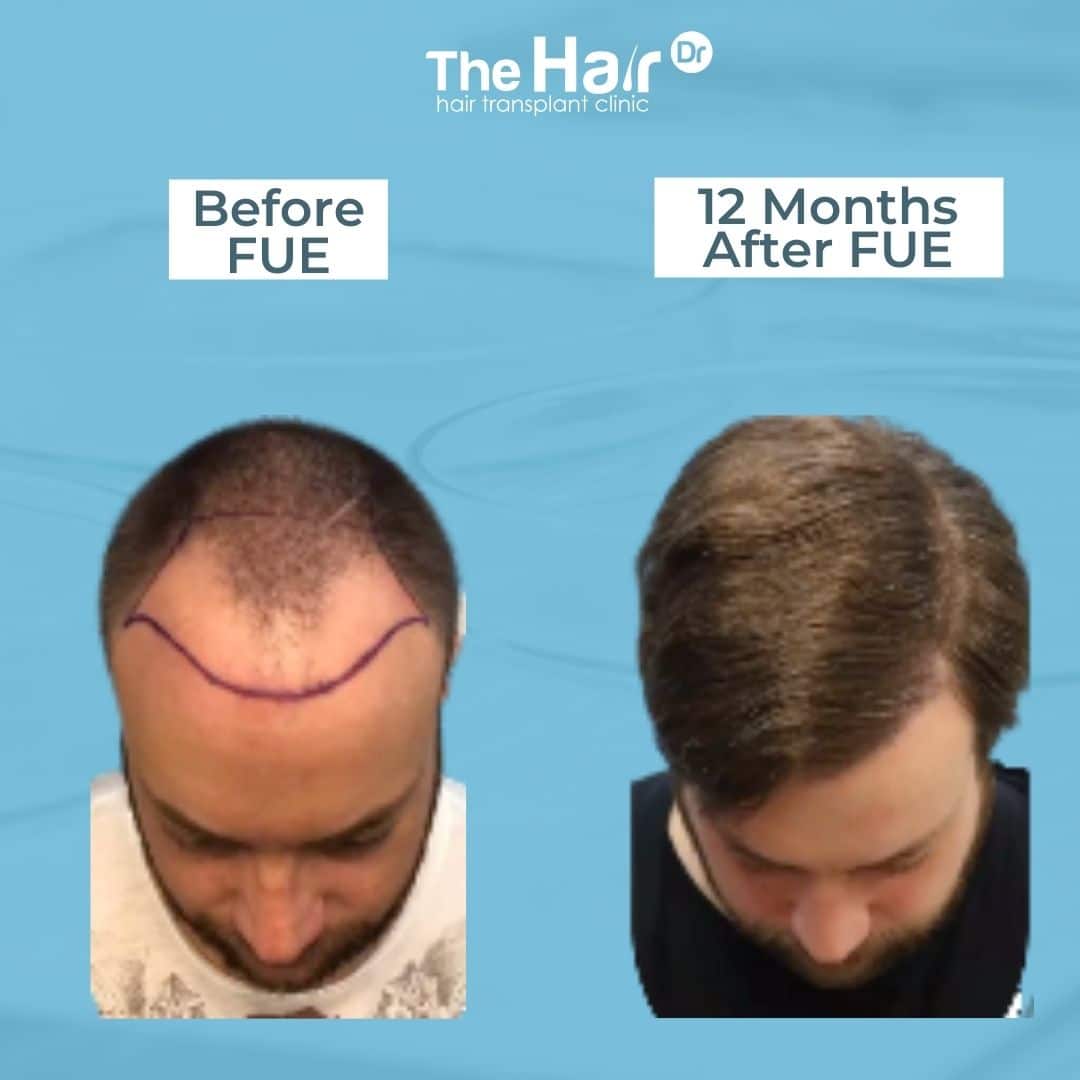 Patient transformation slide 5