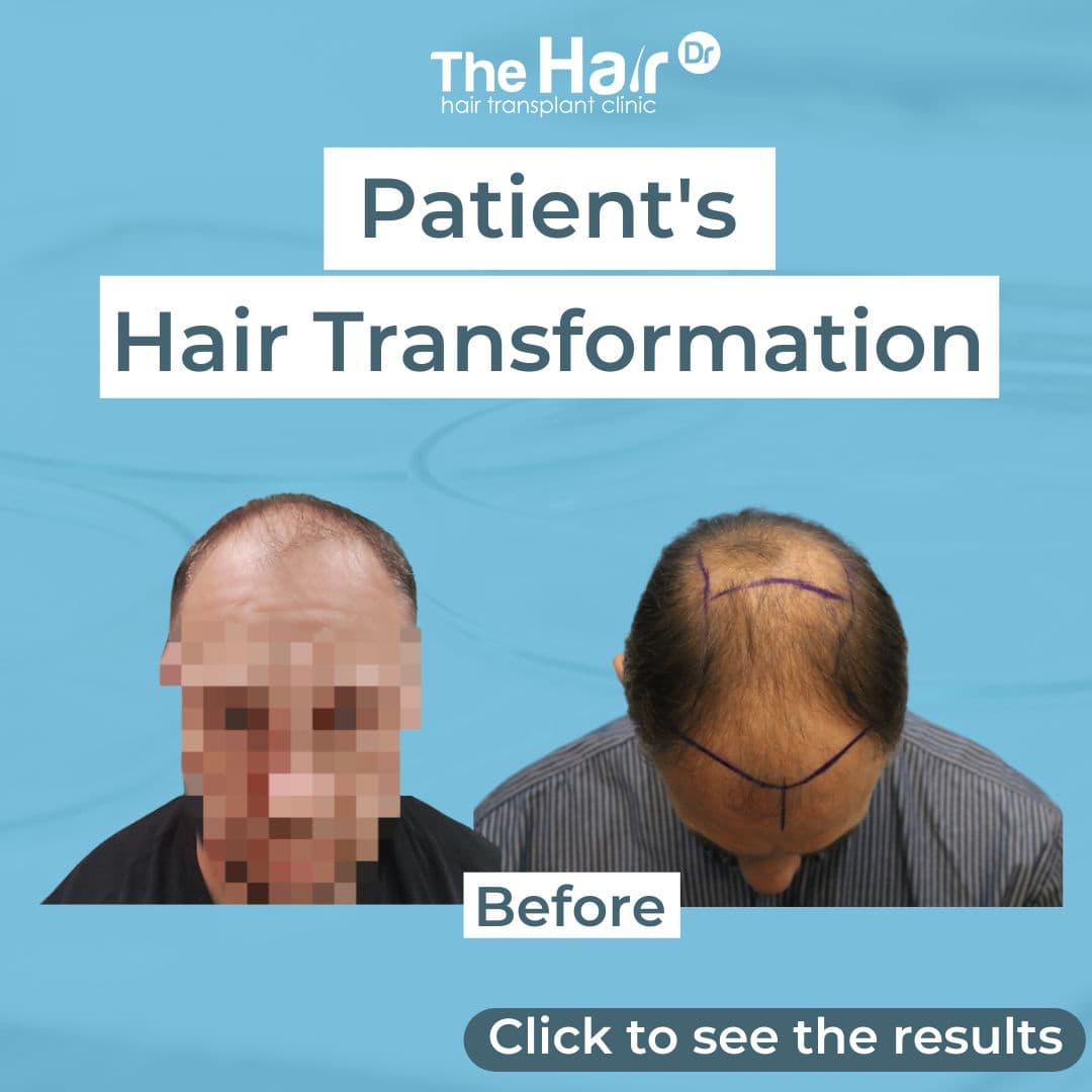 Patient transformation slide 1