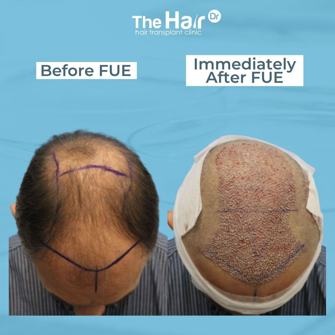 Patient transformation slide 2