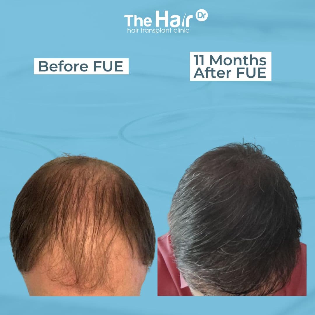 Patient transformation slide 3