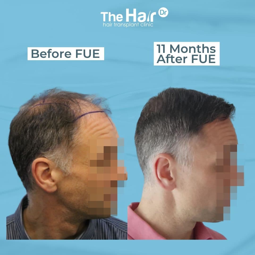 Patient transformation slide 5