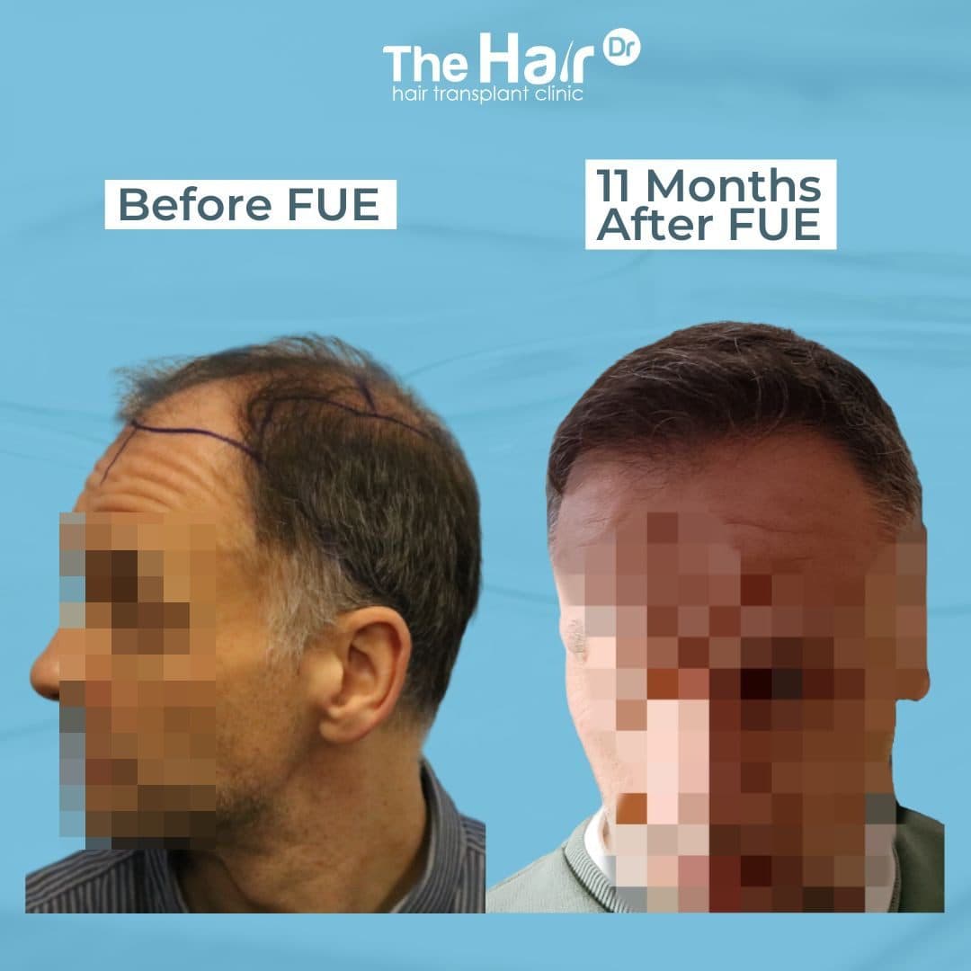 Patient transformation slide 6
