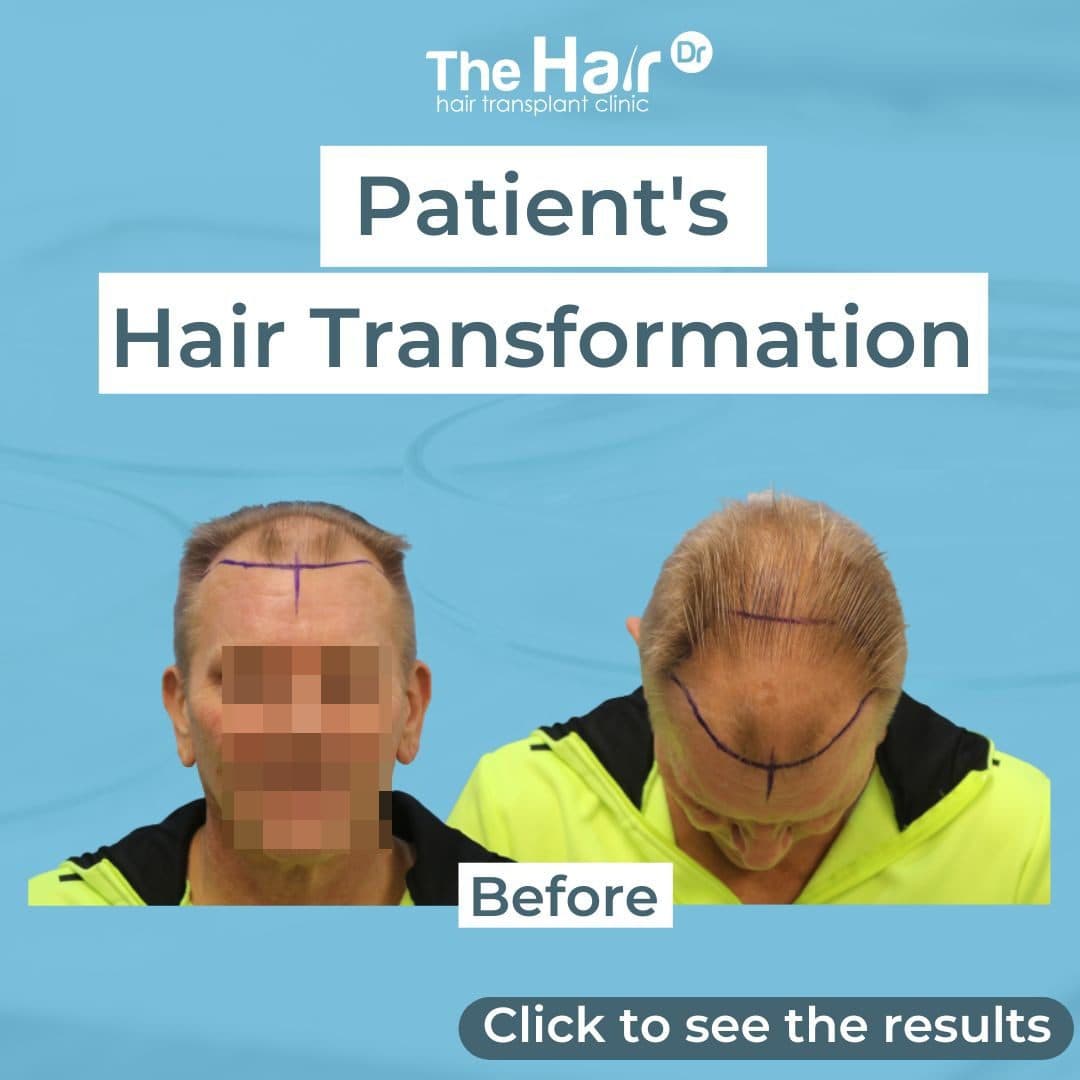 Patient transformation slide 1