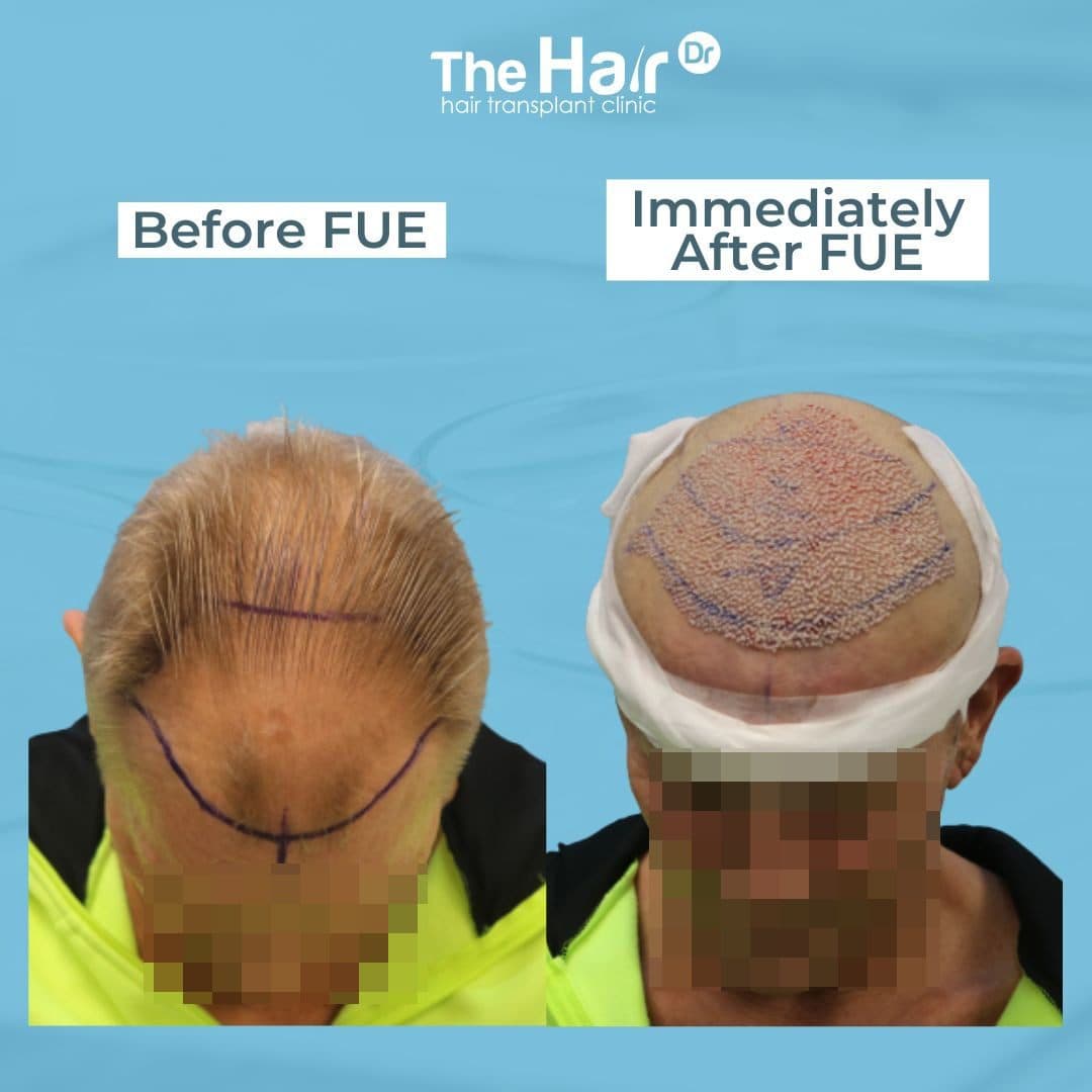 Patient transformation slide 2