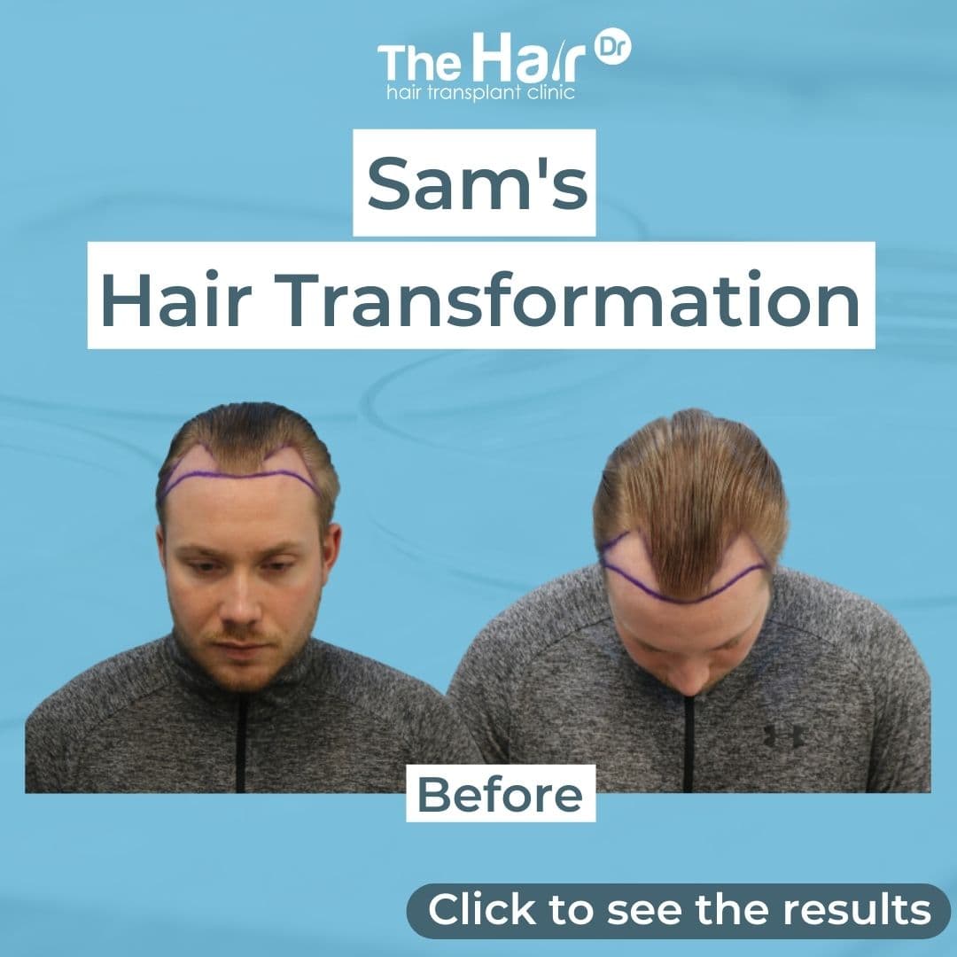 Patient transformation slide 1