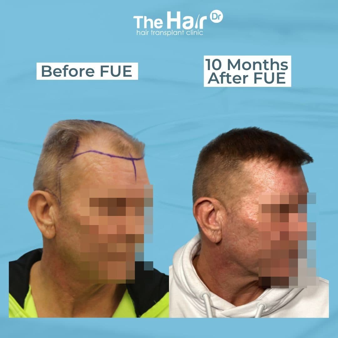 Patient transformation slide 6