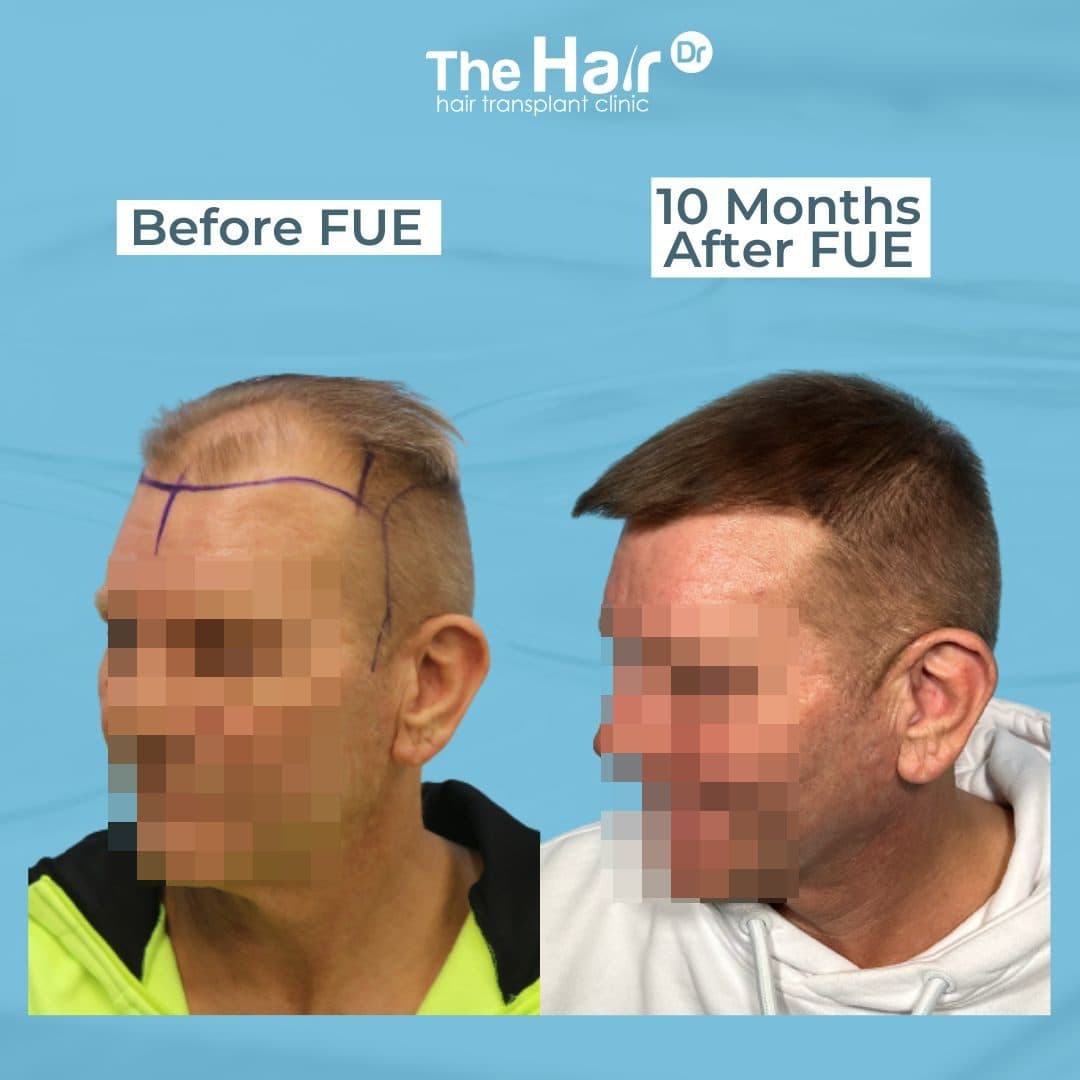 Patient transformation slide 5