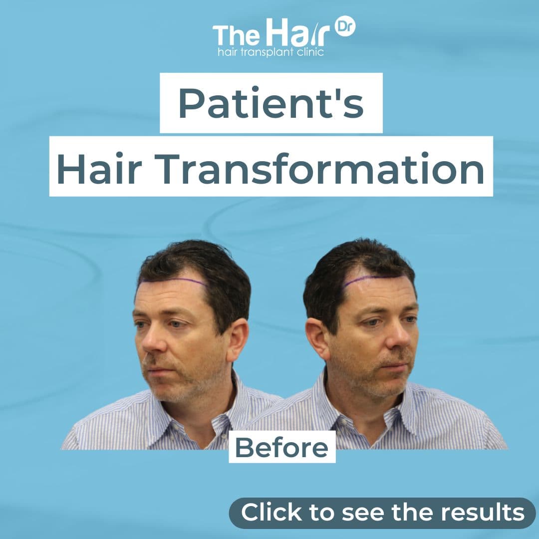 Patient transformation slide 1
