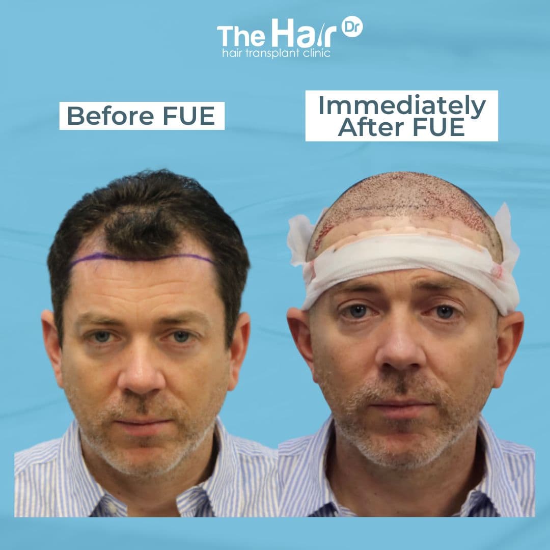 Patient transformation slide 2