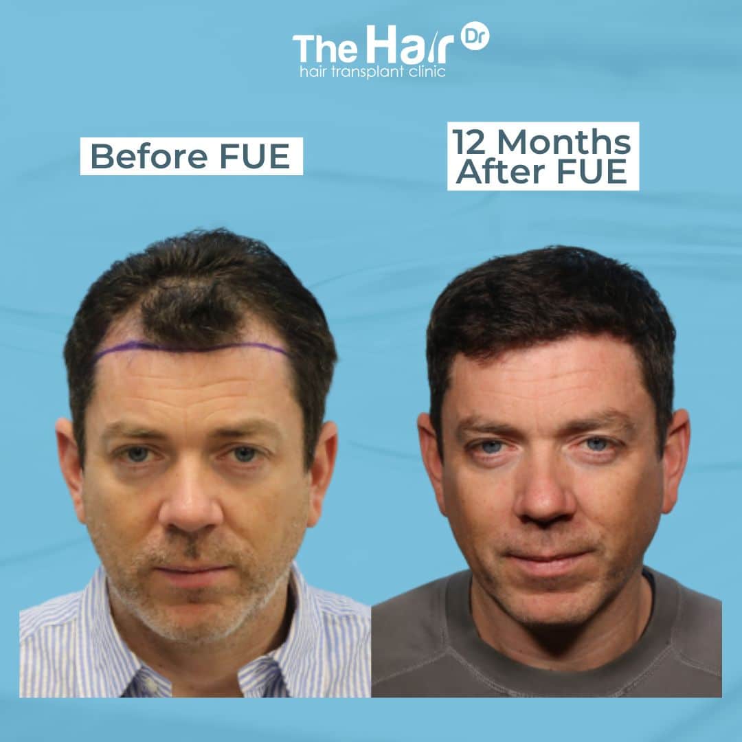 Patient transformation slide 5