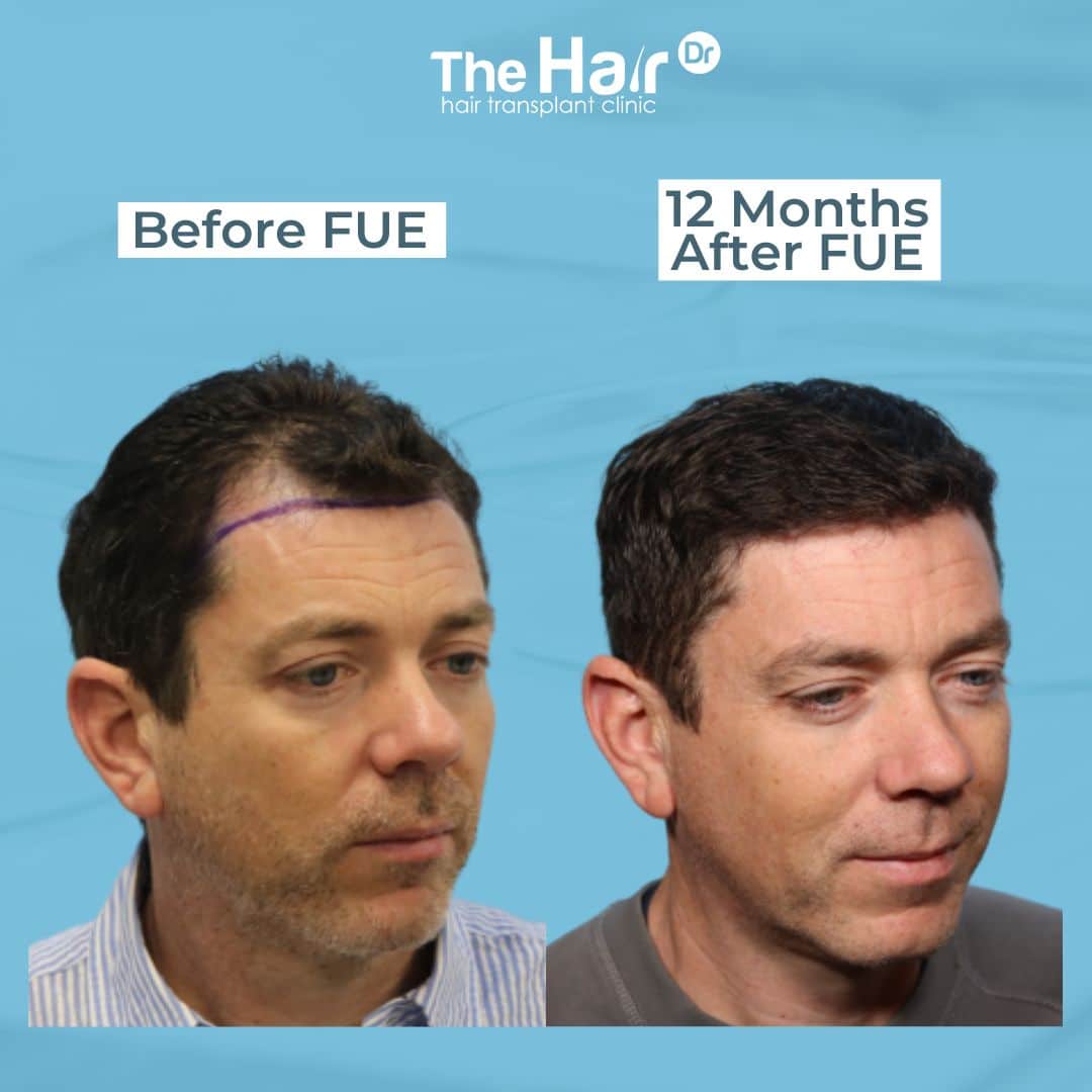 Patient transformation slide 6