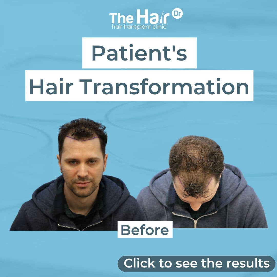 Patient transformation slide 1