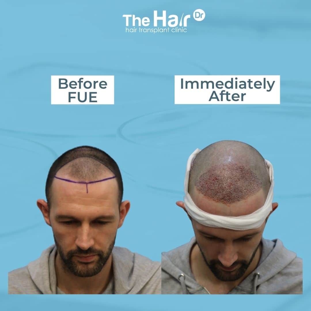 Patient transformation slide 3
