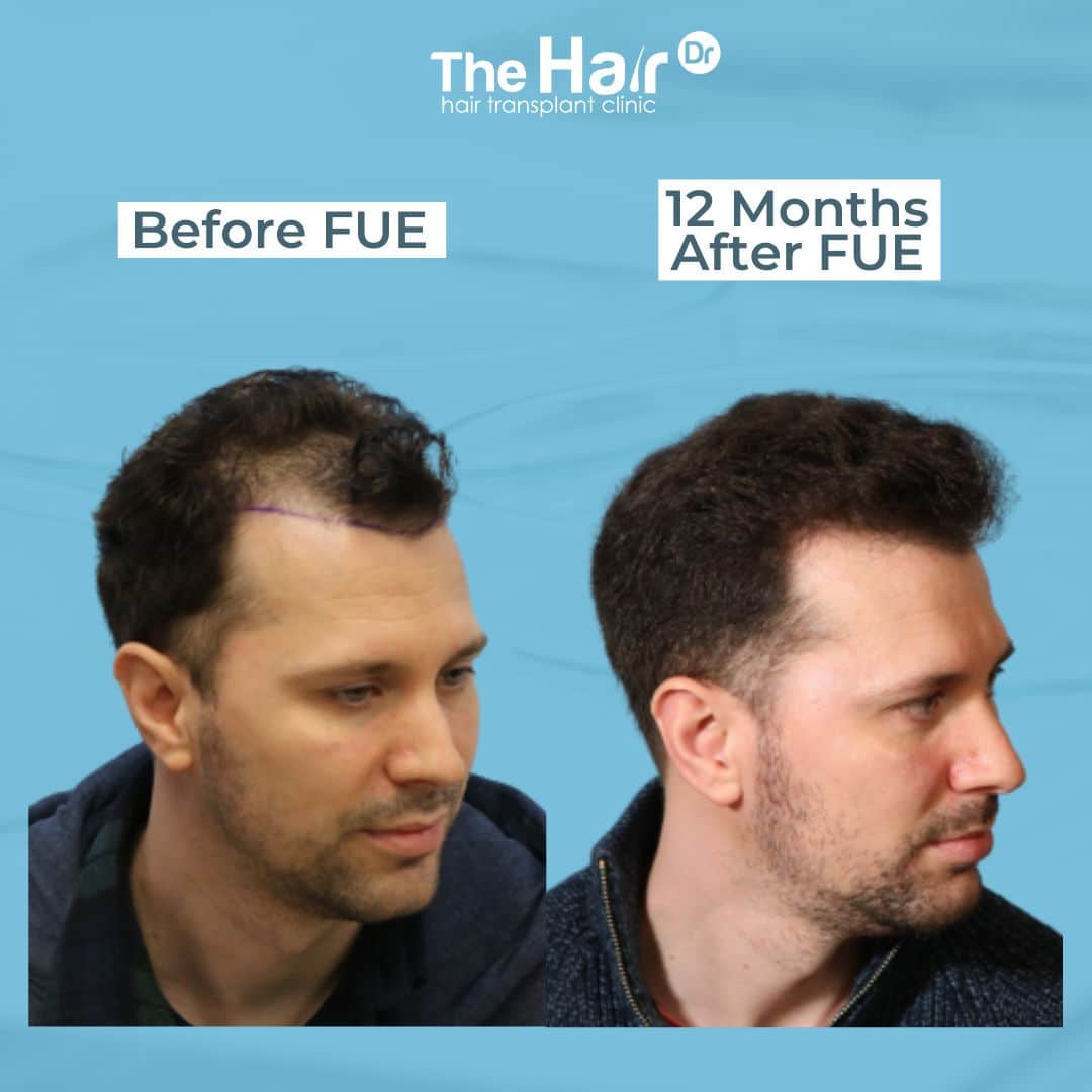 Patient transformation slide 3