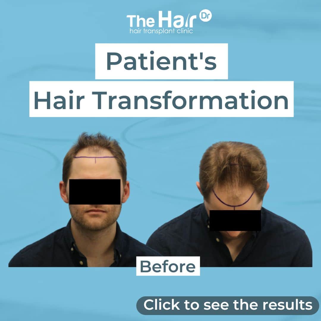 Patient transformation slide 1