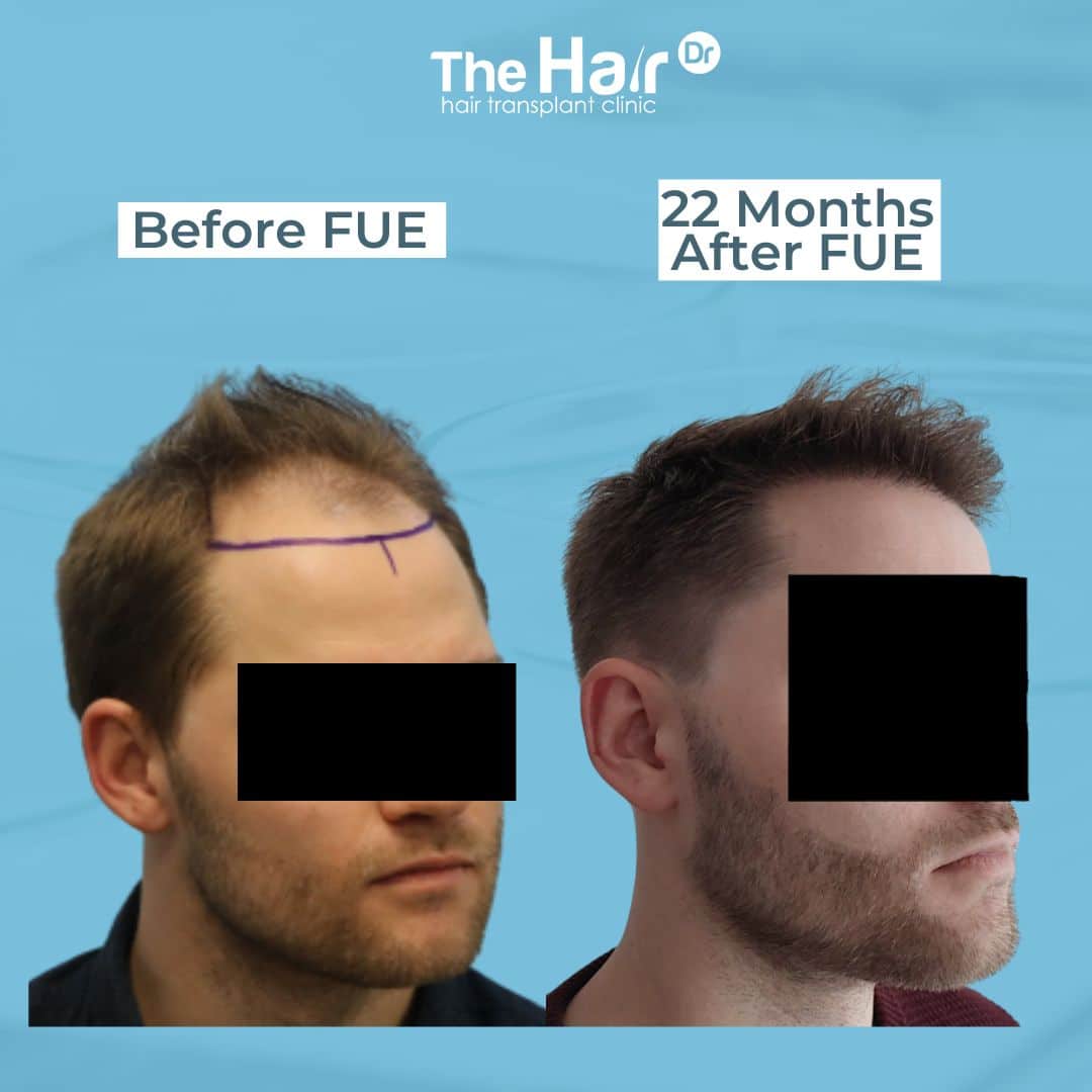 Patient transformation slide 6