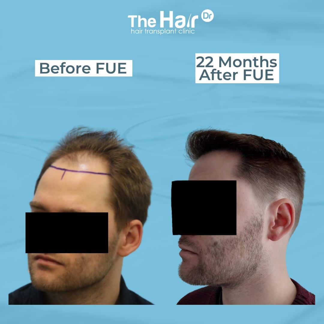 Patient transformation slide 7