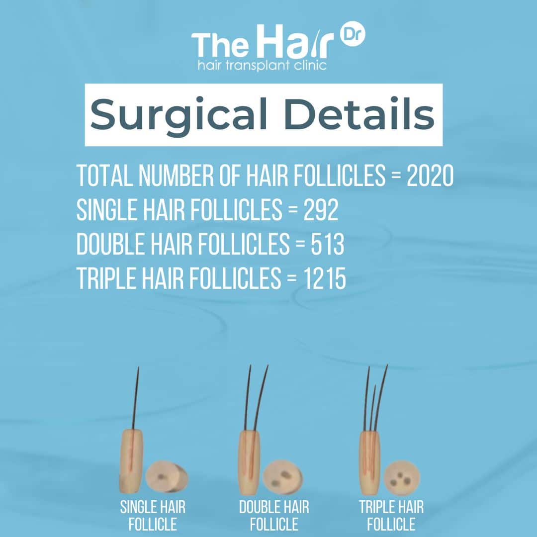 Patient transformation slide 3
