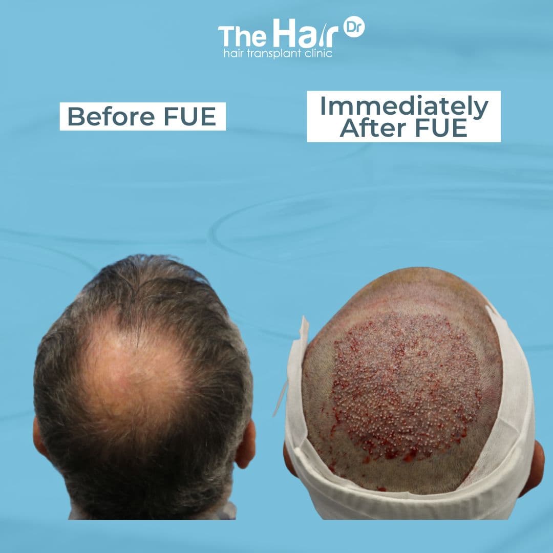 Patient transformation slide 2
