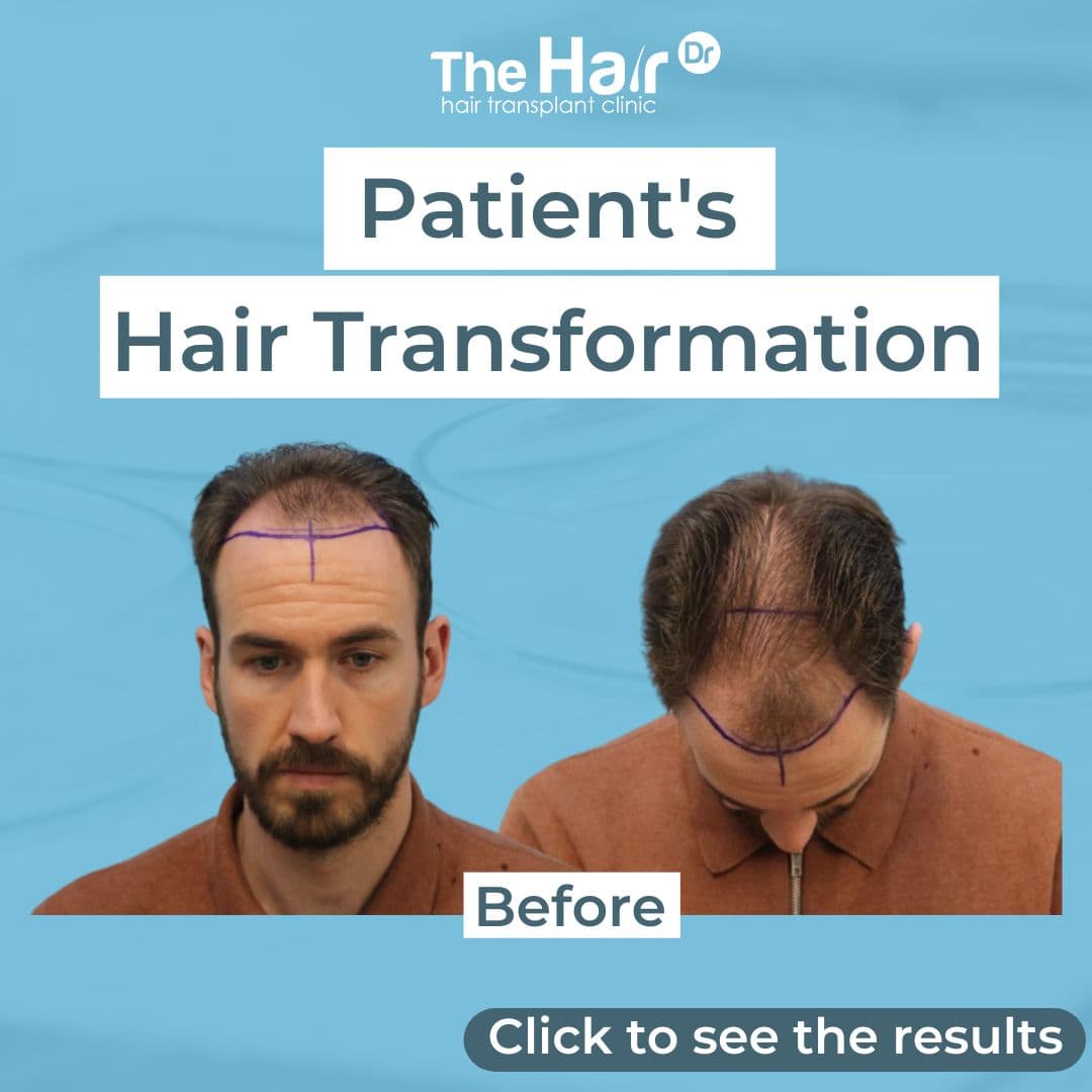Patient transformation slide 1