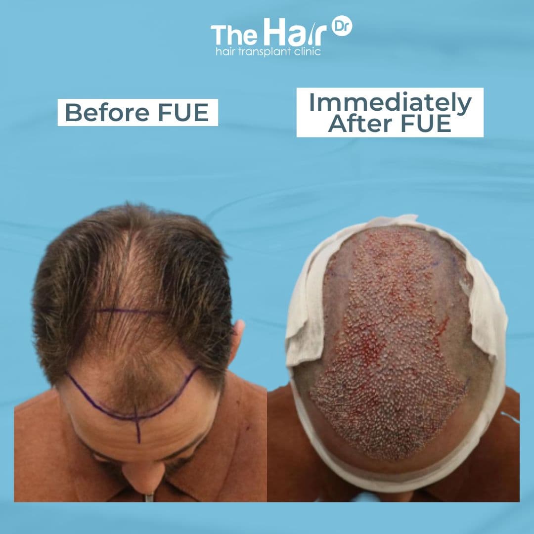 Patient transformation slide 2
