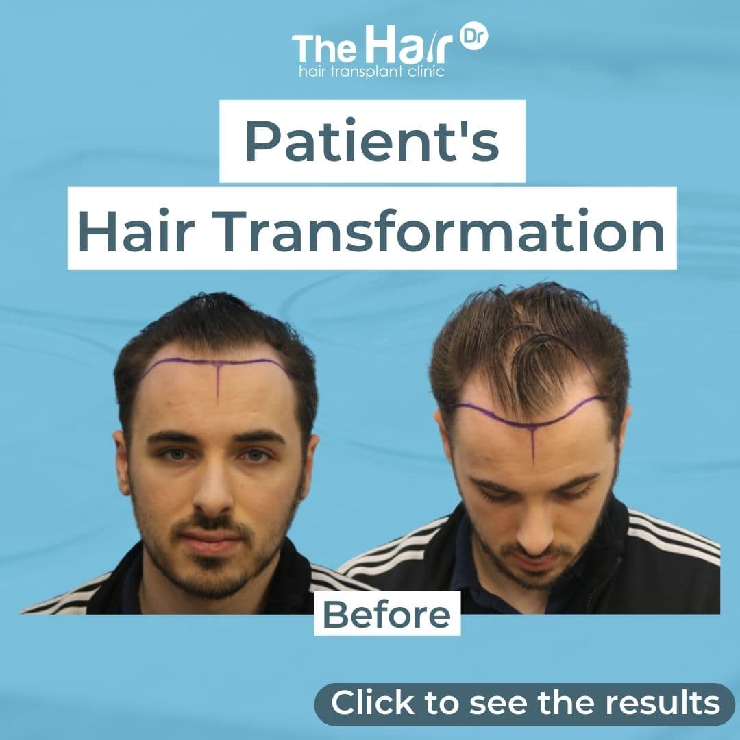 Patient transformation slide 1