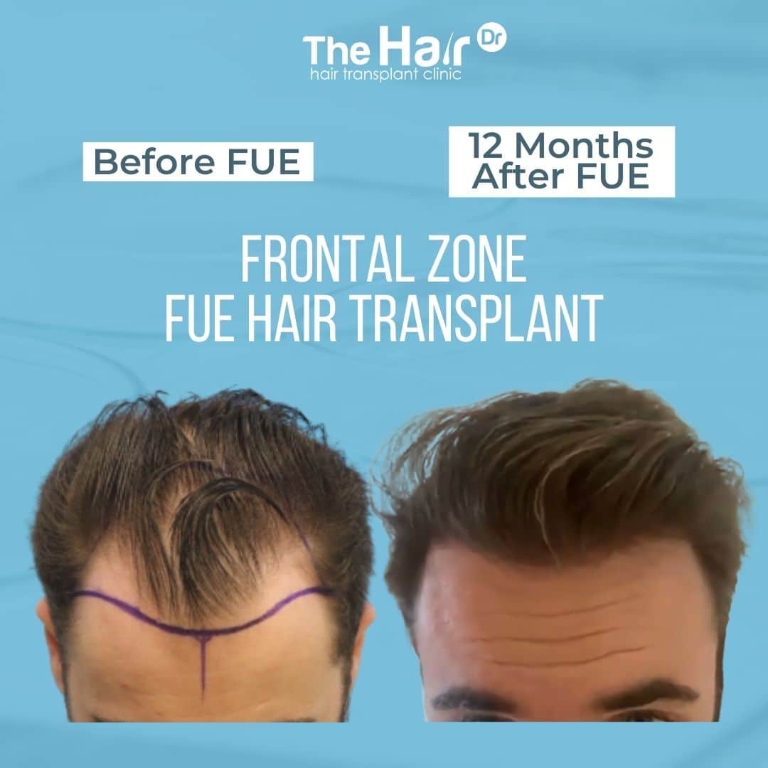 Patient transformation slide 5